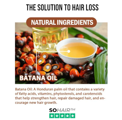 SOHair™ Batana Hair Oil